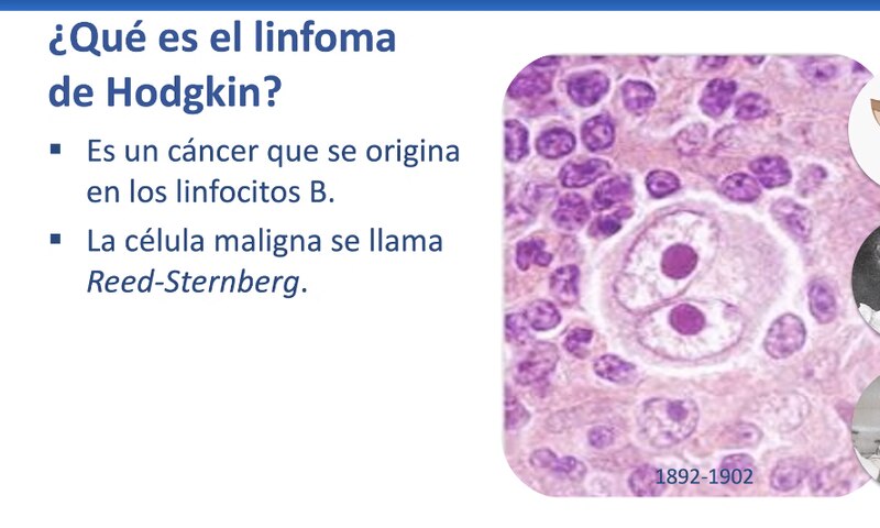 El linfoma de Hodgkin