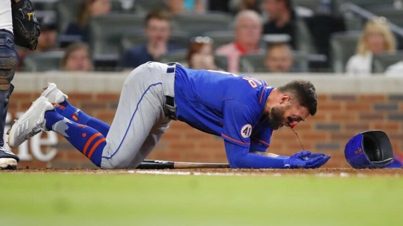 ¡Auch! El jugador de los Mets, Pete Alonso, se duele tras recibir un pelotazo en la cara
