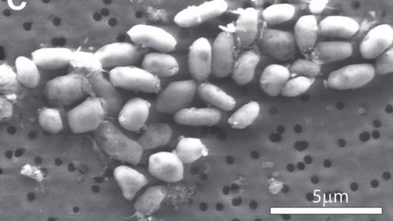 Bacteria GFAJ-1