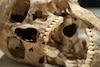 Dientes prehistóricos revelan secretos de enfermedades actuales