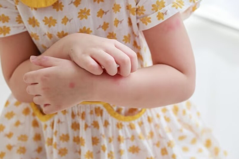 niña rascándose el brazo