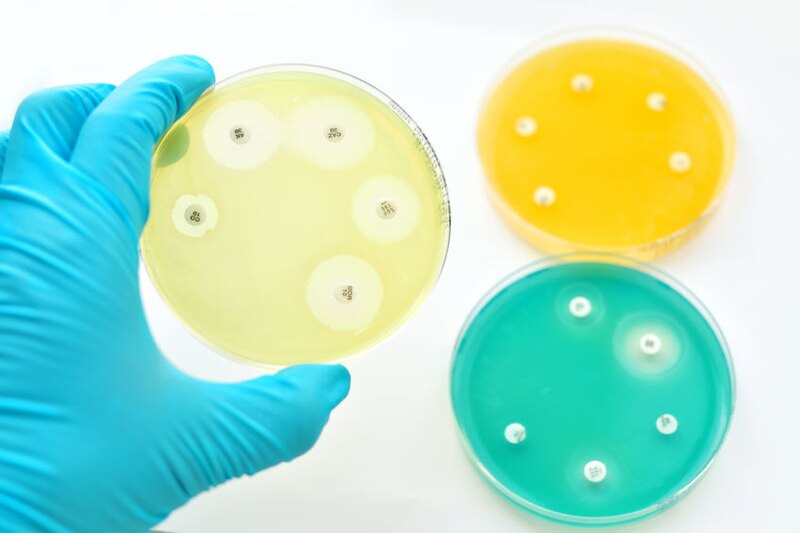 Cultivo de bacterias en placas de Petri