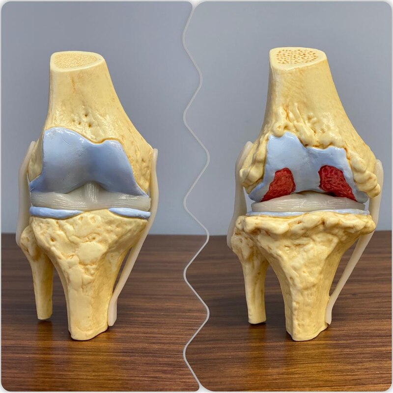 Modelo de rodilla humana