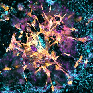 Logran implantar con éxito un embrión en un endometrio artificial