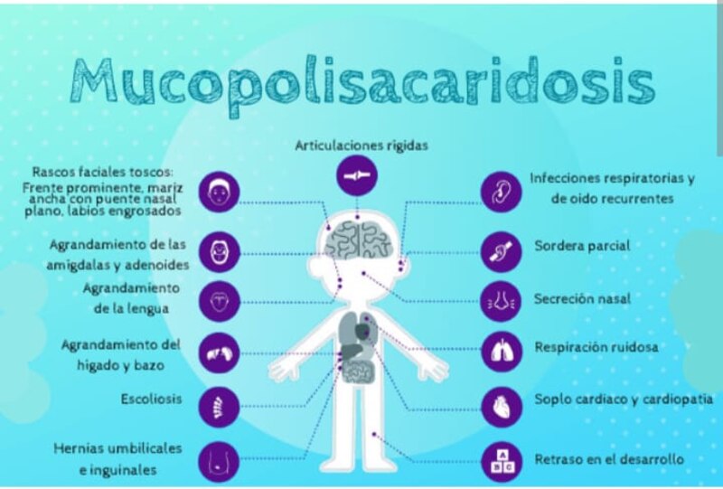 Mucopolisacaridosis