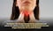 Consumo de tabaco, principal causa del cáncer de cabeza y cuello: Secretaría de Salud