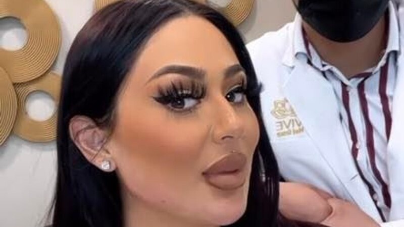 La influencer Yina Calderón muestra su nuevo rostro luego de varias cirugías estéticas