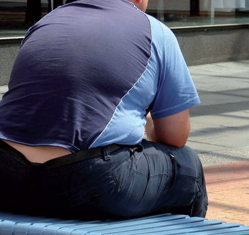 Obesidad