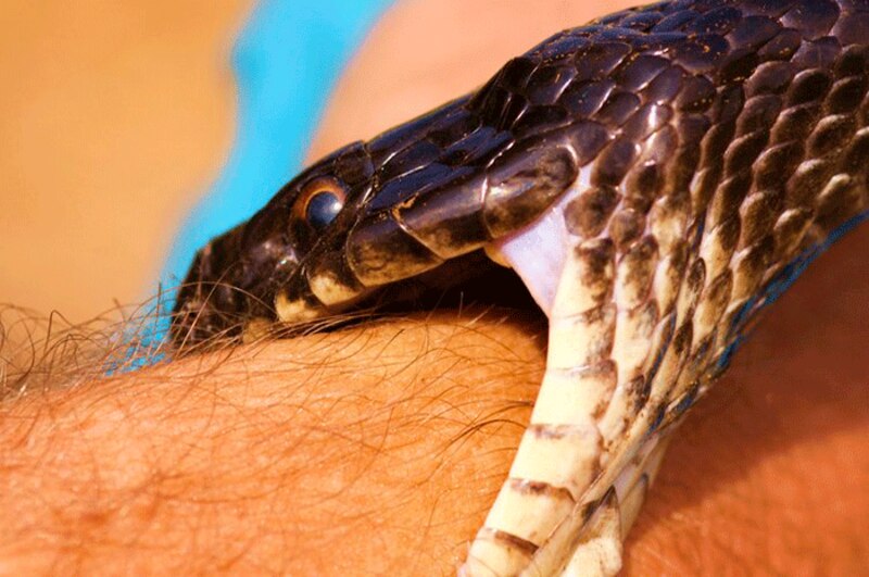 Mordedura de serpiente