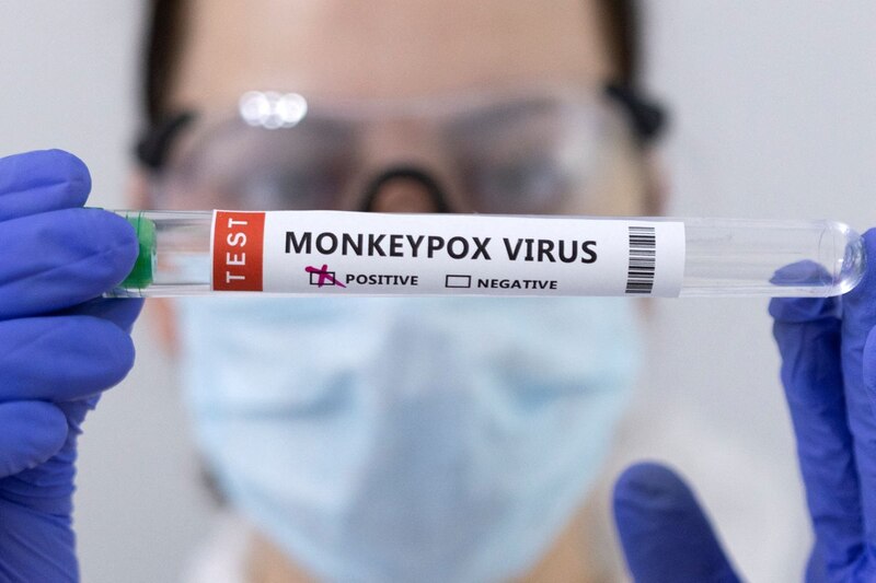 El test del virus de la viruela del mono