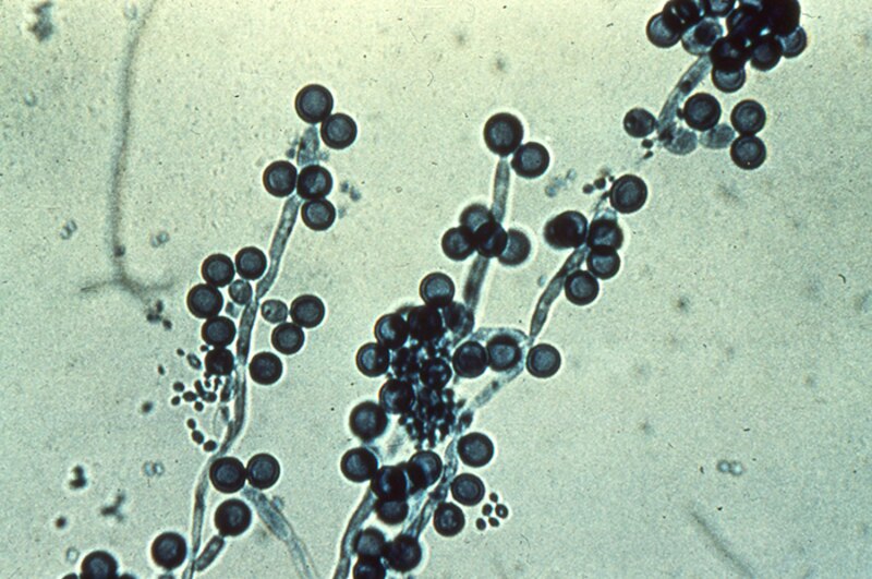 Hongo bajo el microscopio