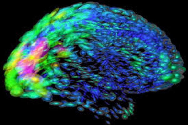Imagen del cerebro humano