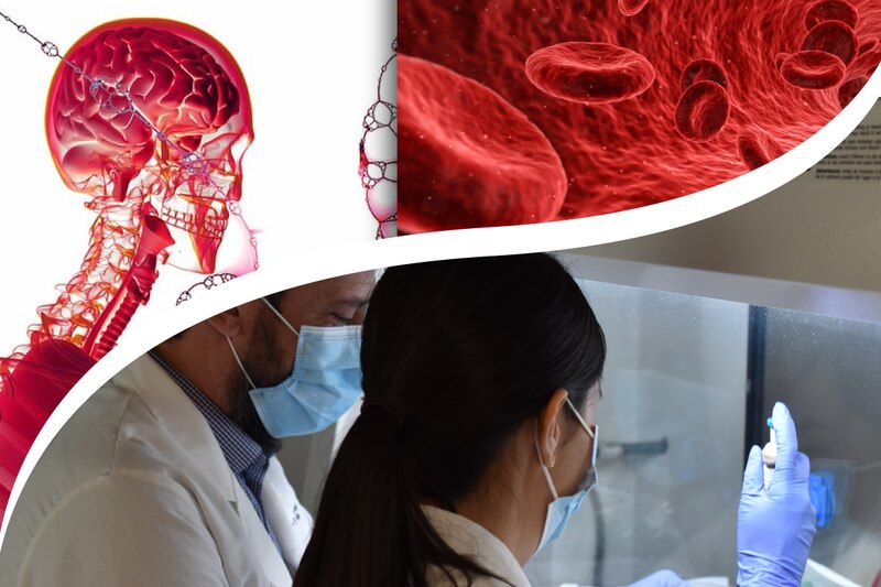Científicos investigan el vínculo entre el cerebro y la sangre