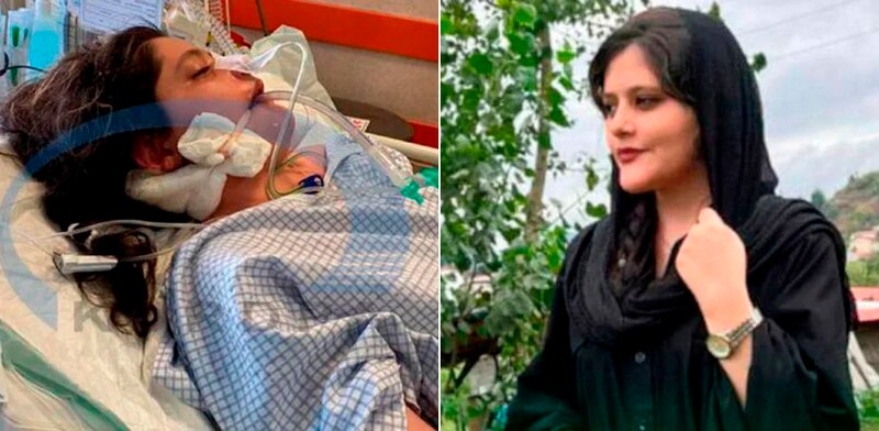 Jovencita es sometida a una cirugía de corazón y sobrevive