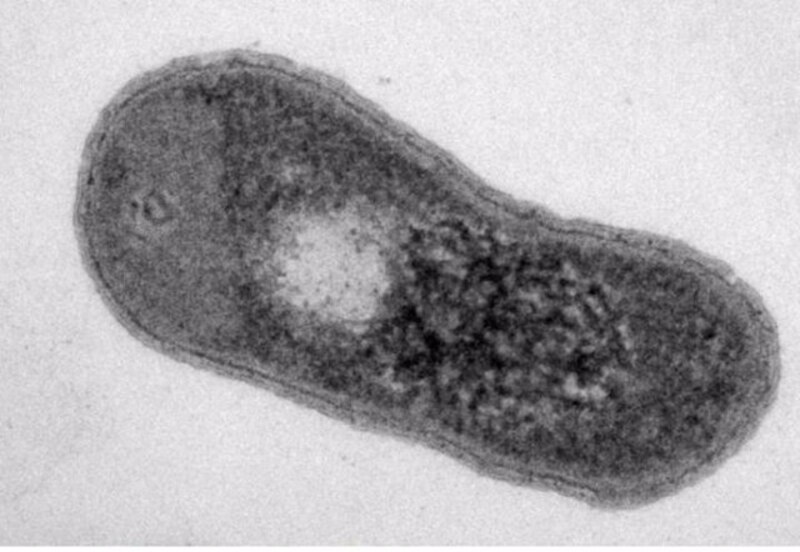 Escherichia coli
