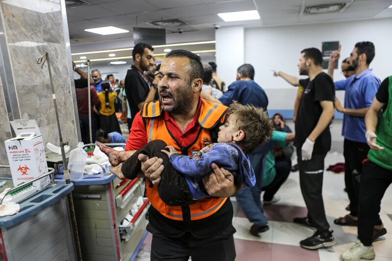 Niño herido en un ataque aéreo en Siria