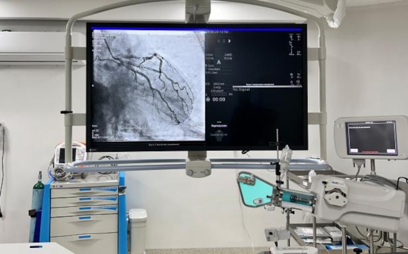 Monitor en sala de hemodinamia mostrando imágenes en tiempo real del procedimiento de embolización hepática.