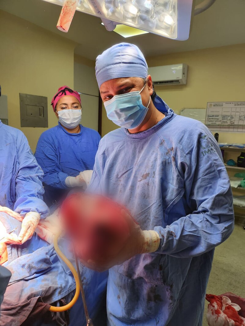 El doctor muestra un tumor extirpado con éxito.