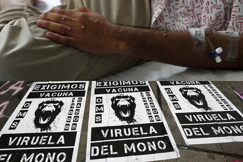 Viruela del mono: OMS pide a los países que estén atentos