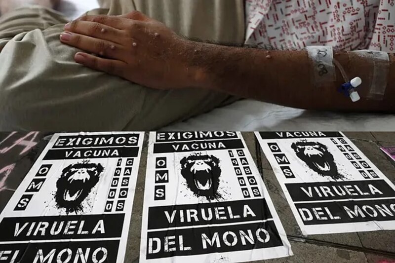 Viruela del mono: OMS pide a los países que estén atentos