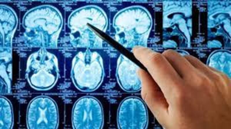 Imagen de resonancia magnética del cerebro