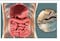 Tres de cada cuatro mexicanos tienen la bacteria de helicobacter pylori y no lo saben 