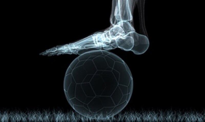 Radiografía de un pie encima de un balón de fútbol