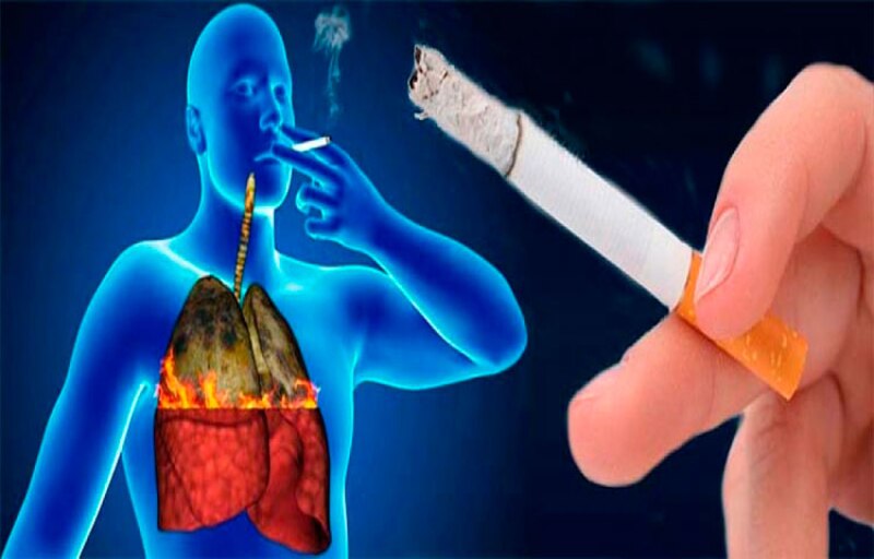 Fumar daña tus pulmones