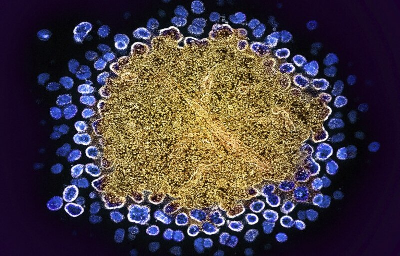 El virus del Zika