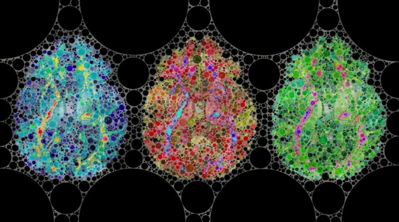 Imagen de resonancia magnética funcional del cerebro