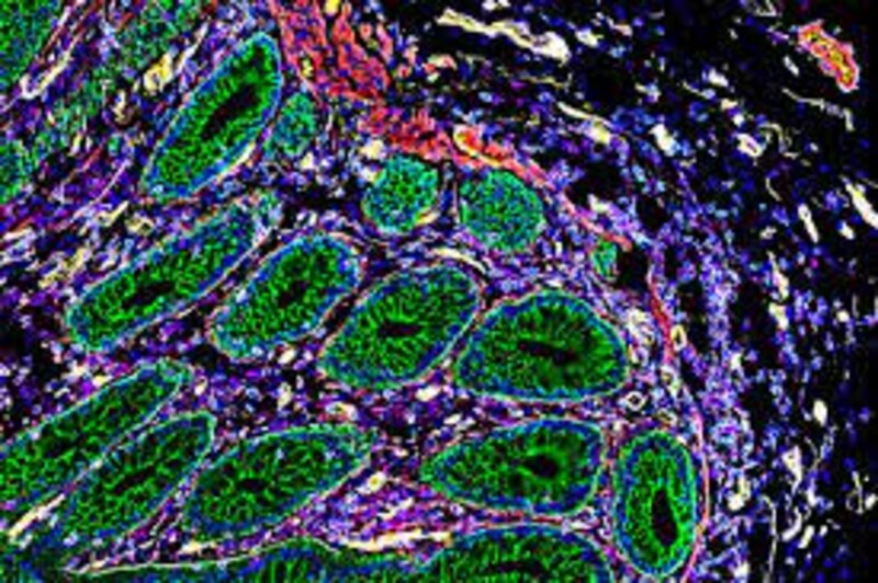 Imagen de microscopía electrónica de barrido de un corte transversal de tejido renal.