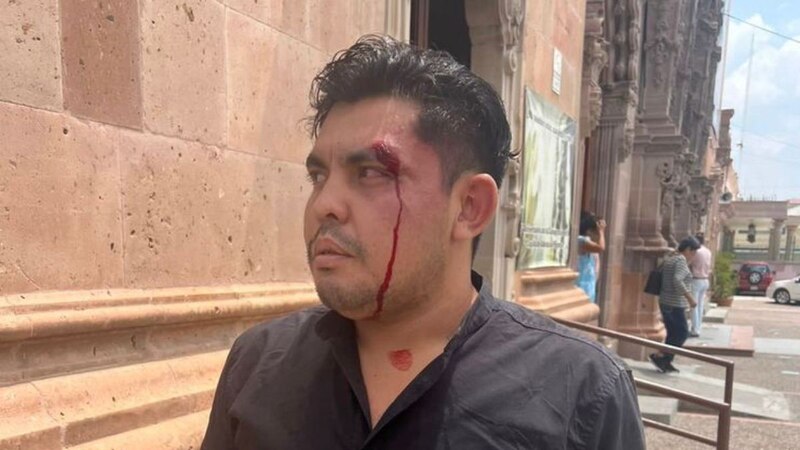 Pelea entre dos hombres deja un herido