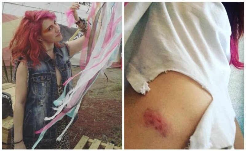 Joven con herida en la espalda