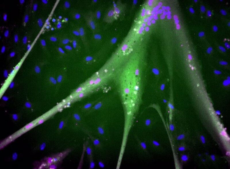 Neuronas