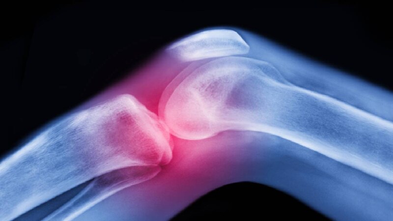 Dolor de rodilla
