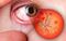 Control de niveles de azúcar por diabetes y salud visual, van de la mano 