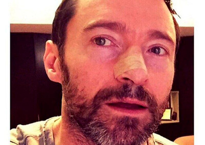 Hugh Jackman muestra su nuevo look para 'Wolverine 3'