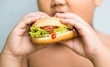 Obesidad infantil: una amenaza silenciosa a la productividad nacional