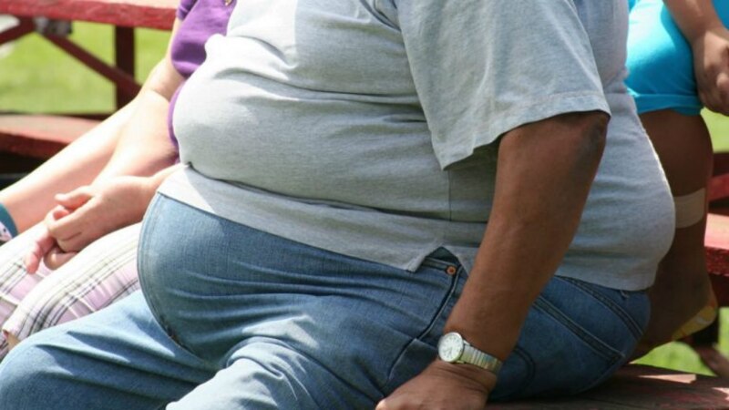 Obesidad: un problema de salud pública