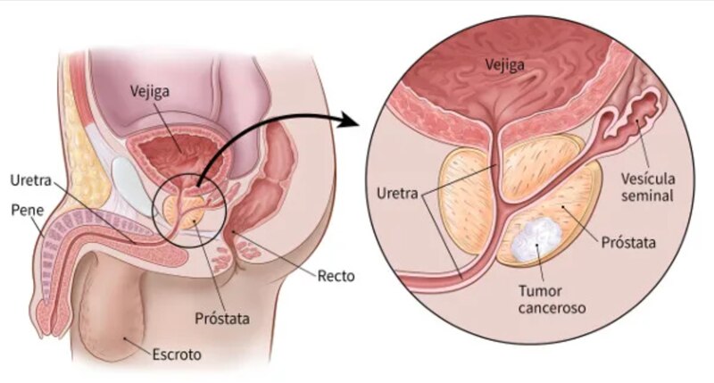 Anatomía de la próstata