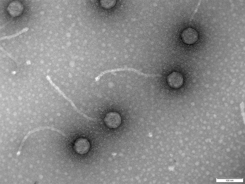Micrografía electrónica de transmisión de un virus