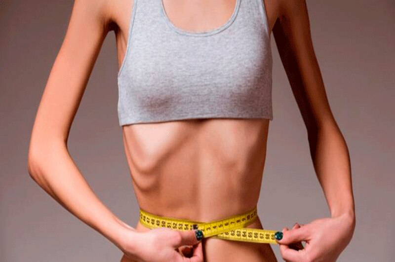 La delgadez extrema puede ser un signo de anorexia