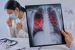 Secretaría de Salud de Sinaloa brinda recomendaciones ante aumento de casos de Tuberculosis 