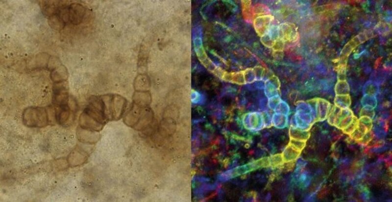 Comparación de bacterias y hongos