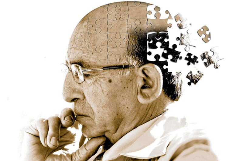 La enfermedad de Alzheimer