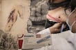 El escorbuto volvió... en forma de Ozempic: el lado oscuro de este medicamento para adelgazar