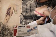 El escorbuto volvió... en forma de Ozempic: el lado oscuro de este medicamento para adelgazar