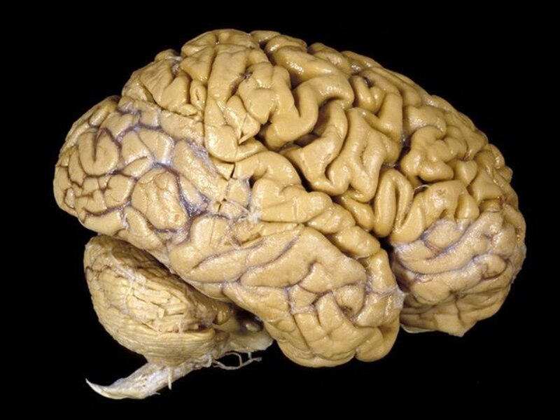 Cerebro humano