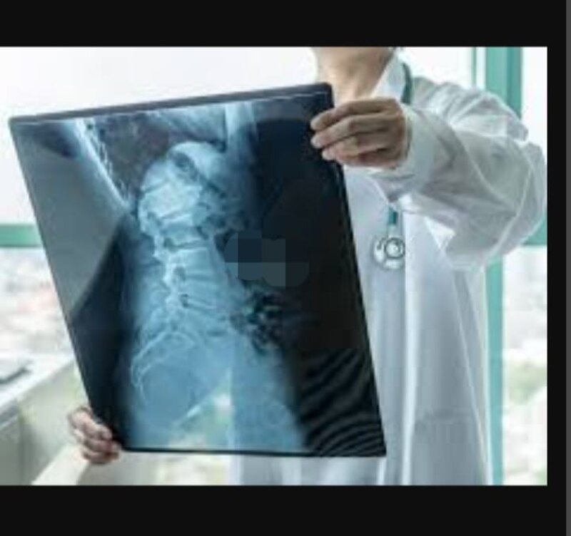 Radiografía de columna vertebral