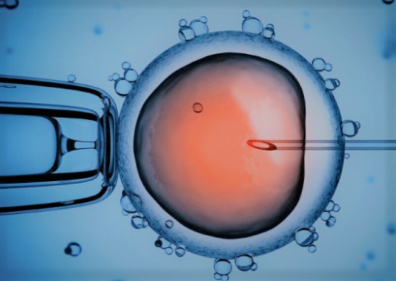 Fecundación in vitro